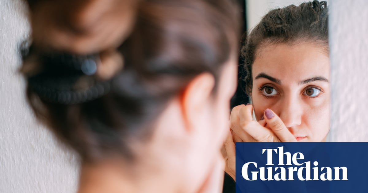‘Ferritin face’: are social media claims about iron deficiency fact – or fiction?